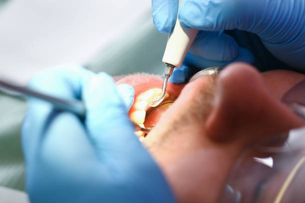 Best Broken or Cracked Tooth Emergency Dentist in Midland, TX