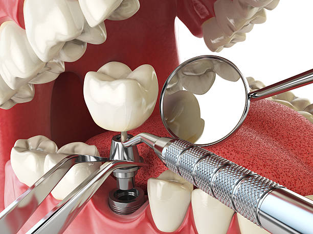 Best Emergency Dental Extractions in Midland, TX